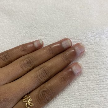 Nail Bar - Mountain View - Damaged nail from filing - Nail Salons Near Me - Mountain View, California Nail Bar - Mountain View - Damaged nail from filing - Nail Salons Near Me - Mountain View, California