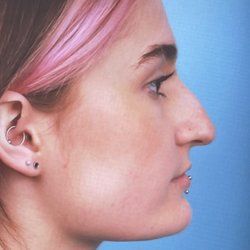 Faces First