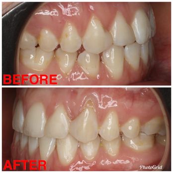 Inessa Kandov, DDS - Bayview Orthodontics - Orthodontists Near Me - Bayside, New York Inessa Kandov, DDS - Bayview Orthodontics - Orthodontists Near Me - Bayside, New York