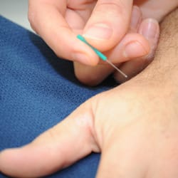 Gillian Powers - Crossings Healing and Wellness - An acupuncture needle