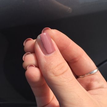 Phoenix Nails & Spa - My nail chipped on the top left corner; got caught in my hair, & ripped down to what you see. - Nail Salons Near Me - Los Alamitos, California Phoenix Nails & Spa - My nail chipped on the top left corner; got caught in my hair, & ripped down to what you see. - Nail Salons Near Me - Los Alamitos, California