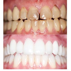 Desert Dental Care - La Quinta Dentist