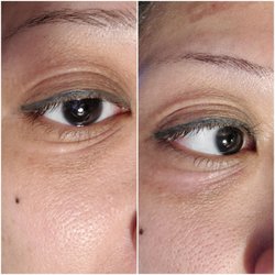 Touch of the Dragonfly  Spa - Under eye tightening before/after 3 week progression.