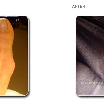 Kamran Jamshidinia, DPM, FACFAS - bunion surgery - Podiatrists Near Me - Los Angeles, California Kamran Jamshidinia, DPM, FACFAS - bunion surgery - Podiatrists Near Me - Los Angeles, California