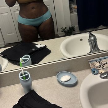 Pure Plastic Surgery - 1 week post op after 7th lymphatic massage. - Cosmetic Surgeons Near Me - Miami, Florida Pure Plastic Surgery - 1 week post op after 7th lymphatic massage. - Cosmetic Surgeons Near Me - Miami, Florida
