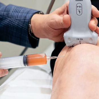 Cohen Medical Center - Ultrasound-guided injections for precise joint pain relief by Dr. Cohen in Thousand Oaks. - Medical Centers Near Me - Thousand Oaks, California Cohen Medical Center - Ultrasound-guided injections for precise joint pain relief by Dr. Cohen in Thousand Oaks. - Medical Centers Near Me - Thousand Oaks, California