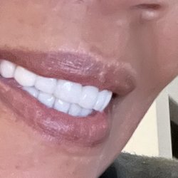 1385 Dental Studio - Pearly Whites  Dr. Hala Mustafa 1385 Dental Studio in Aubrey, Texas.