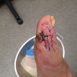Family Foot and Ankle Specialists