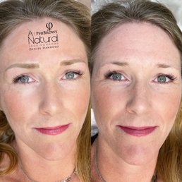 Before & After Before & After