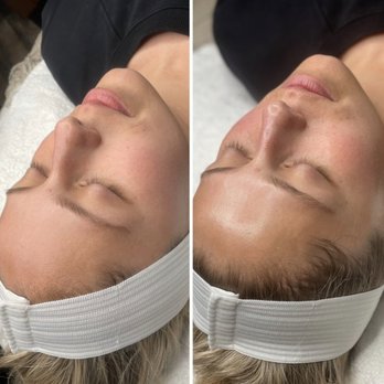Lashes + Beauty - Hydro Facial - Eyelash Service Near Me - Murrieta, California
