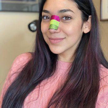 William Portuese, MD - Rhinoplasty patient - Plastic Surgeons Near Me - Seattle, Washington William Portuese, MD - Rhinoplasty patient - Plastic Surgeons Near Me - Seattle, Washington