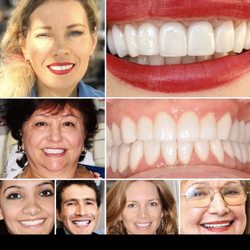 Tomas Anderkvist, DDS - UNFORGETTABLE SMILES ARE LIFE CHANGING!