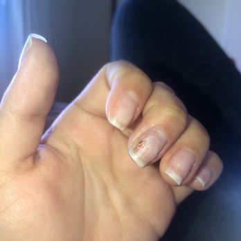 AZ Admire Nails & Spa - Drilled to my nail bed - Waxing Near Me - Chandler, Arizona