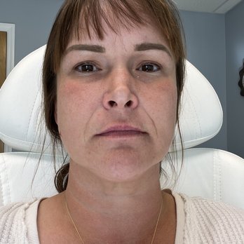 Harpe Laser + Wellness - Before. See the 11's. - Laser Hair Removal Near Me - Asheville, North Carolina Harpe Laser + Wellness - Before. See the 11's. - Laser Hair Removal Near Me - Asheville, North Carolina