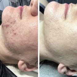 Glow Skincare