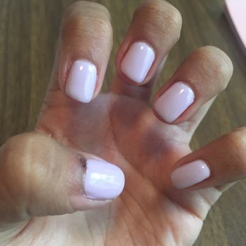 Deluxe Nail Spa - You can see the area where my cuticle was cut. - Hair Removal Near Me - Bradenton, Florida Deluxe Nail Spa - You can see the area where my cuticle was cut. - Hair Removal Near Me - Bradenton, Florida