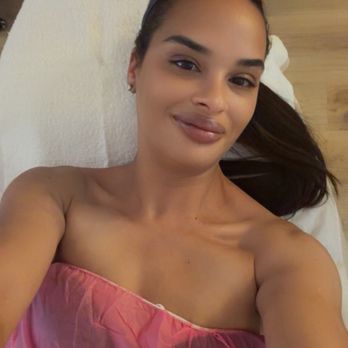 Alo Derma Med Spa - My skin , its so soft and glowing - Medical Spas Near Me - San Diego, California