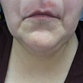 Lush Beauty Lounge - Burns from the wax. It was really hot and burned for hours after. - Nail Salons Near Me - Hemet, California