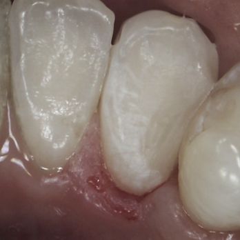 Holly Dental Associates - Cosmetic Dentists Near Me - Centennial, Colorado