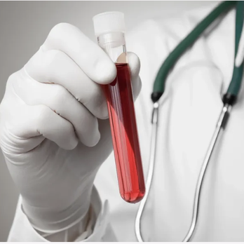 Compassion Care Mobile Phlebotomy - Laboratory Testing Near Me