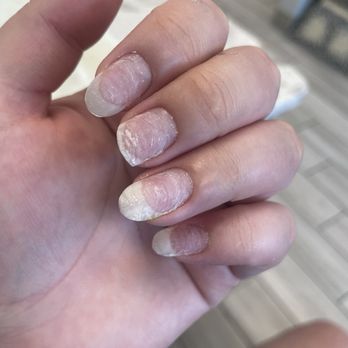 Nails Art - Left hand after soak no skin damage or redness - Nail Salons Near Me - Pittsburg, California