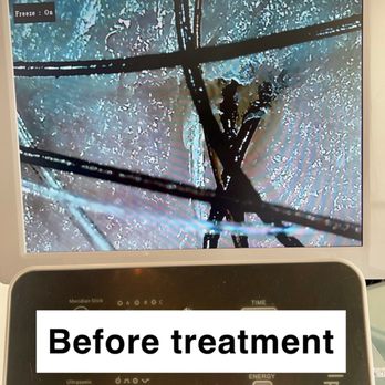 TT Head Spa - This is my scalp and hair before the treatment. Gross! - Hair Salons Near Me - Arcadia, California