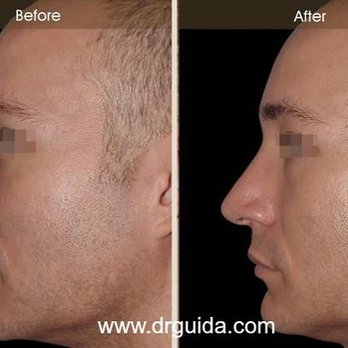 Robert Guida, MD - Cosmetic Surgeons Near Me - New York, New York Robert Guida, MD - Cosmetic Surgeons Near Me - New York, New York
