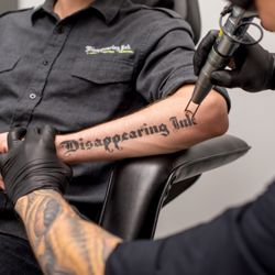 Removery Tattoo Removal & Fading