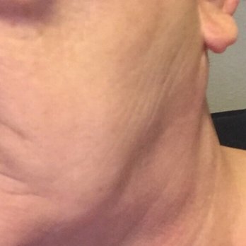 Terry Dubrow, M.D - Cosmetic Surgeons Near Me - Newport Beach, California Terry Dubrow, M.D - Cosmetic Surgeons Near Me - Newport Beach, California