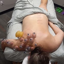 Naturally, At Peace Wellness Center - Relief  cupping!