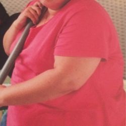 ACG Plastic Surgery- Dr. Alexandra Conde Green - 328 lbs