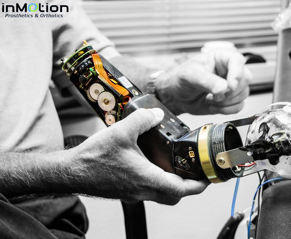 AOD PROSTHETICS & ORTHOTICS Updated September 2024 15303 Huebner Rd