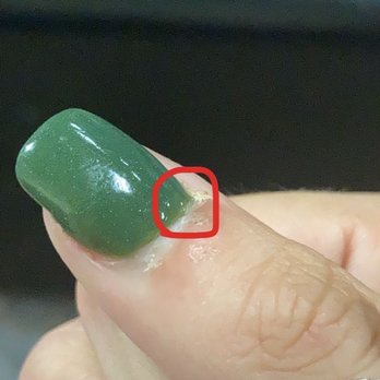 American Nails Salon - SNS FAIL this is where she put the activator on my cuticle (I had to fix it myself with a file it was throbbing!) - Nail Salons Near Me - Jacksonville, Florida