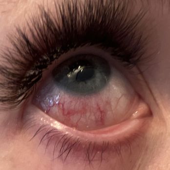 Mirror Mirror Beauty Salon and Supply - Redness from glue/ fumes in my eye. Redness lasted a week. - Hair Salons Near Me - Temecula, California Mirror Mirror Beauty Salon and Supply - Redness from glue/ fumes in my eye. Redness lasted a week. - Hair Salons Near Me - Temecula, California