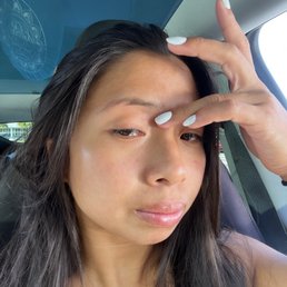 Patch of my eyebrow is missing