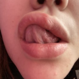 Bumpy filler