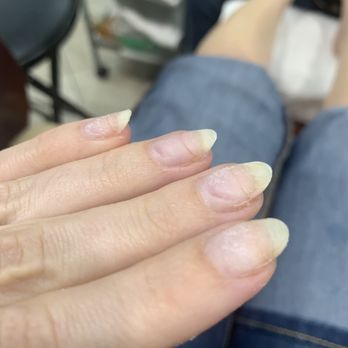 Sky Nail Salon & Spa - Older woman used the electric file and created deep grooves into my nails, almost exposing the nail-bed skin underneath. - Skin Care Near Me - Anaheim, California Sky Nail Salon & Spa - Older woman used the electric file and created deep grooves into my nails, almost exposing the nail-bed skin underneath. - Skin Care Near Me - Anaheim, California