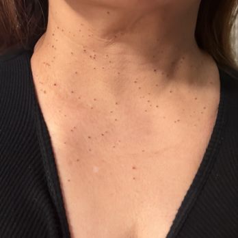 O Skin Medspa - Skin Care Near Me - Cerritos, California