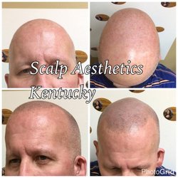 A Permanent Solution: Permanent Cosmetics By Theresa - Scalp Micropigmentation Before & After 201-970-3244