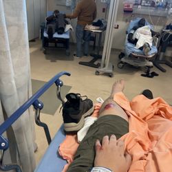 Shands Emergency Room - After looking at my janky leg and giving me a little pain killers and an x ray. I just wanted ibuprofen and an MRI.