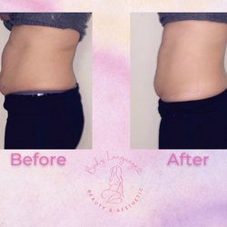 Body Lanuage Beauty & Aesthetic - Body sculpting