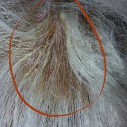 Melted saran wrap in completely damaged hair. This is what Chantelle Casey did all over my daughter's head. Melted saran wrap in completely damaged hair. This is what Chantelle Casey did all over my daughter's head.