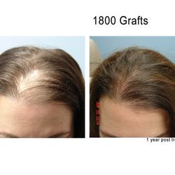 Sacramento Hair Doctor
