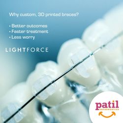 Patil Orthodontics - LightForce Braces