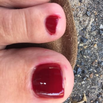 Bella Beach Nail Spa - No joke--what my toes looked like in parking lot after leaving. - Nail Salons Near Me - Ashburn, Virginia Bella Beach Nail Spa - No joke--what my toes looked like in parking lot after leaving. - Nail Salons Near Me - Ashburn, Virginia