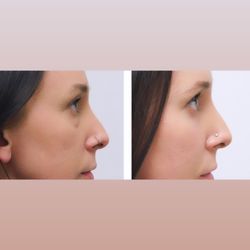 McLain Surgical Arts - Before and After