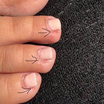 Nails Nails Nails - The three toes shown are of my nail cut more than she should have. I'm so upset and they still had the nerve to charge me the pedicure - Nail Salons Near Me - Whittier, California Nails Nails Nails - The three toes shown are of my nail cut more than she should have. I'm so upset and they still had the nerve to charge me the pedicure - Nail Salons Near Me - Whittier, California