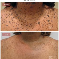 Derma Laser Centers