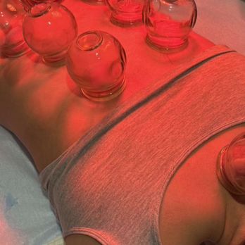 QQ Body Work - We offer complimentary cupping as an add-on to your treatment, if you'd like. - Massage Therapy Near Me - New York, New York