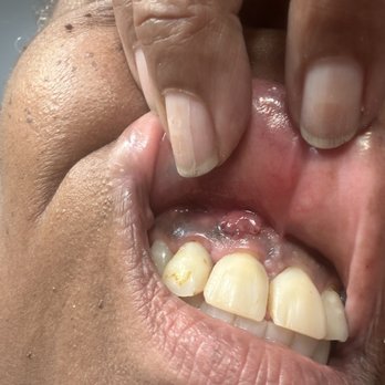Clear Choice Riverside - Infection gums - Cosmetic Dentists Near Me - Riverside, California Clear Choice Riverside - Infection gums - Cosmetic Dentists Near Me - Riverside, California